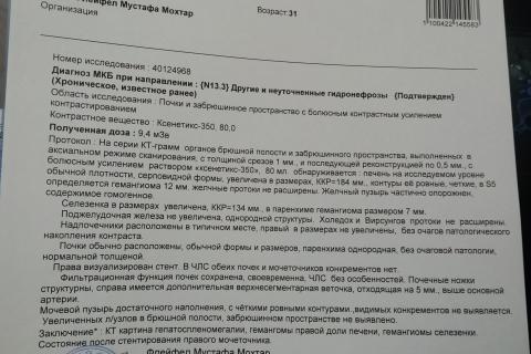 Раковая опухоль